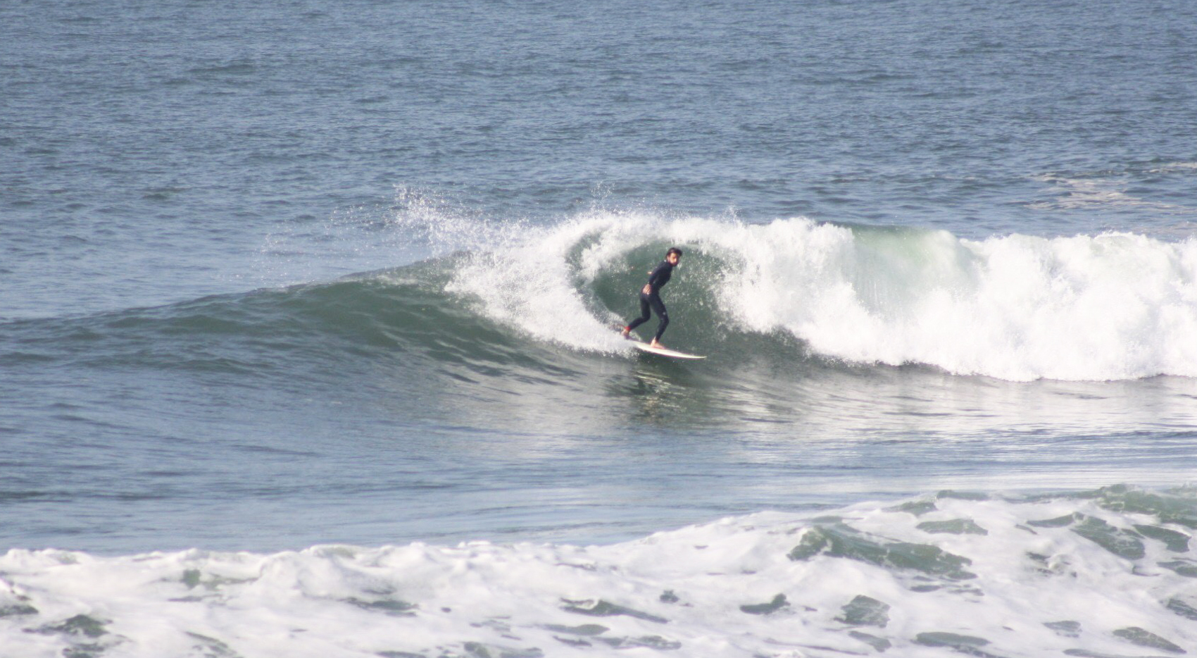 Surfista fratura dente com a prática do surf, excerto com implante.